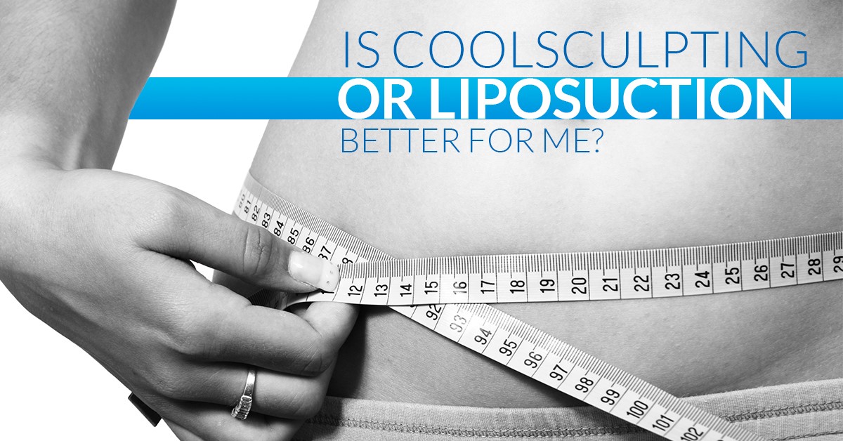 TENGO GRASA LOCALIZADA: ¿ME HAGO LIPOSUCCIÓN O COOLSCULPTING? NUESTRAS DOCTORAS TE LO EXPLICAN