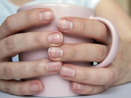 TUS UÑAS DICEN MUCHO SOBRE TU SALUD