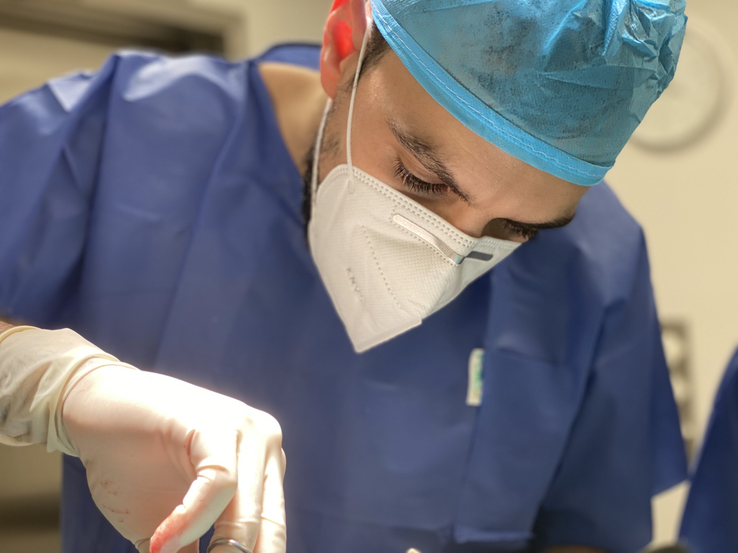 Por qué el cáncer de piel debe tratarse con la cirugía de Mohs