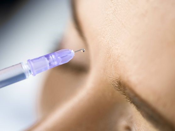 ¿ En qué consiste el nuevo Bótox?