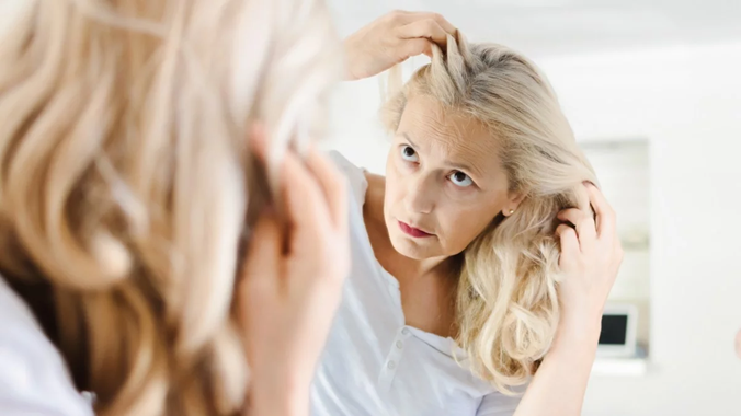 Alopecia frontal fibrosante: la calvicie de la diadema
