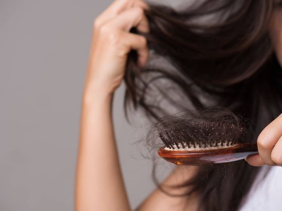5 verdades sobre la calvicie femenina que todos deberíamos conocer