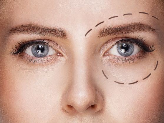 Quiero mejorar mis párpados: ¿voy al dermatólogo o al cirujano plástico?
