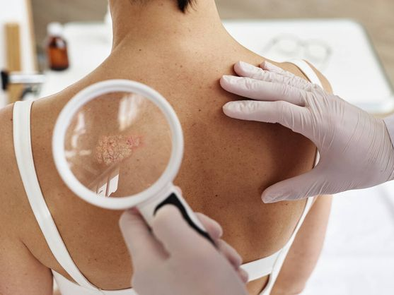 LAS 6 VERDADERAS RAZONES POR LAS QUE LOS MIR ELIGEN DERMATOLOGÍA